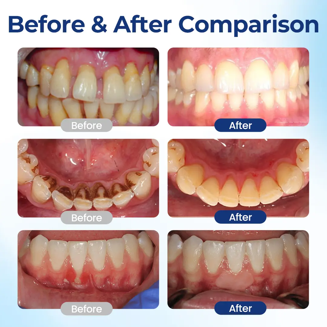 Zensu® BeeTakt Oral Repair Solution.